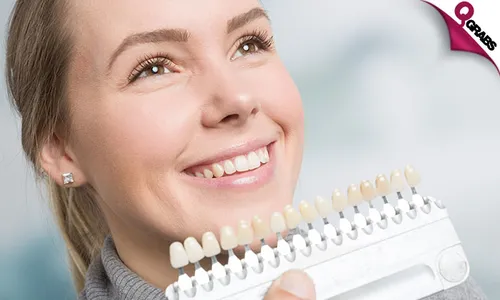 Composite Veneers + Scaling + Polishing & More!